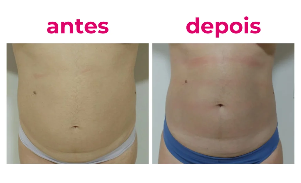 Resultado real do protocolo - Resultado 5